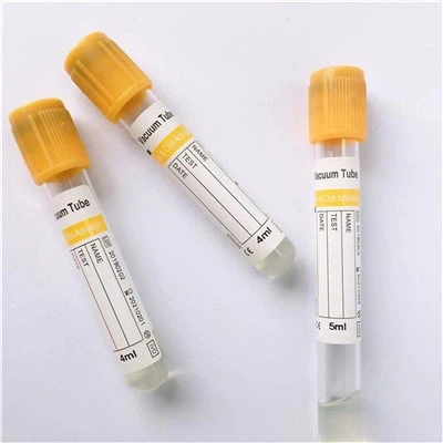 Radyo uygulamaları için düz vakum tüpü nasıl seçilir?